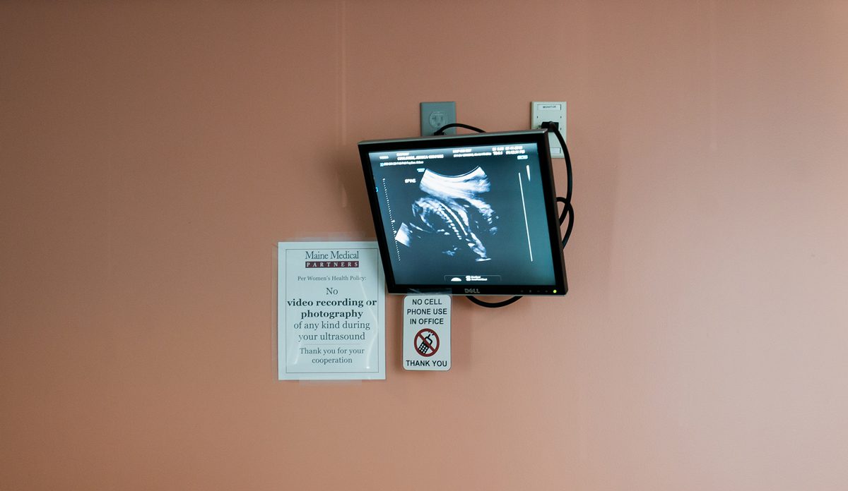 The ultrasound image of Jessica Coulombe’s fetus is displayed on a monitor during her five-month appointment in July at Maine Medical Center in Portland. Photo by Yoon S. Byun.