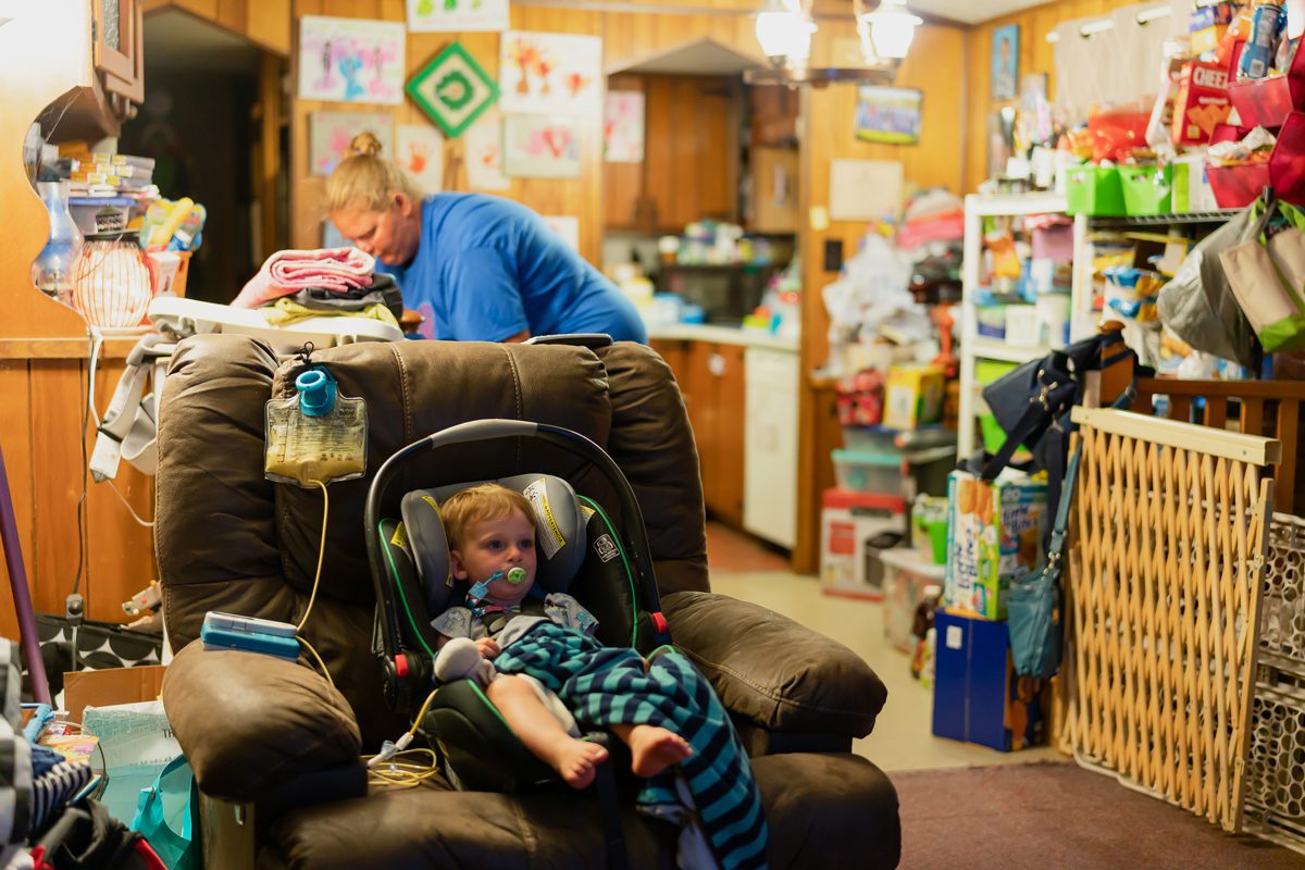 Monmouth, ME, United States -- Jay Patrick's "J.P." gets nourishment from a feeding tube in the living room before bedtime in Monmouth, ME on Wednesday, August 8, 2018. Hasch adopted J.P. and his older brother Devon, and J.P. was an NAS baby who arrived at 4 weeks with withdrawal symptoms that included tremors, rashes, vomiting and constant screaming. J.P. got a feeding tub in July 2017 which improved his quality of life. (Photo by Yoon S. Byun)